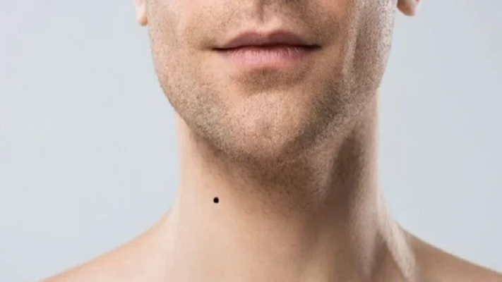 not-ruoi-moc-o-co-dan-ong-1